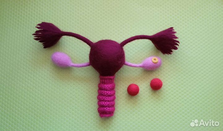 Матка модель