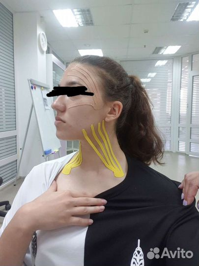 Тейпирование