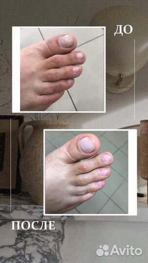 Аппаратный педикюр