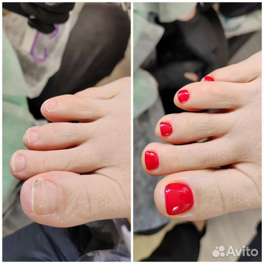 Маникюр, педикюр, наращивание