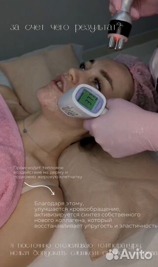 Омоложение лица рф-лифтинг