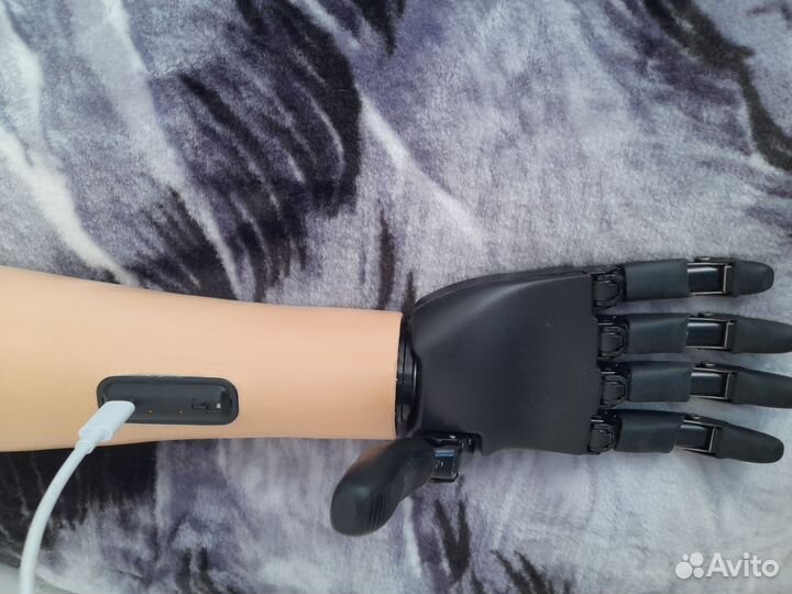 Бионический протез на правую руку