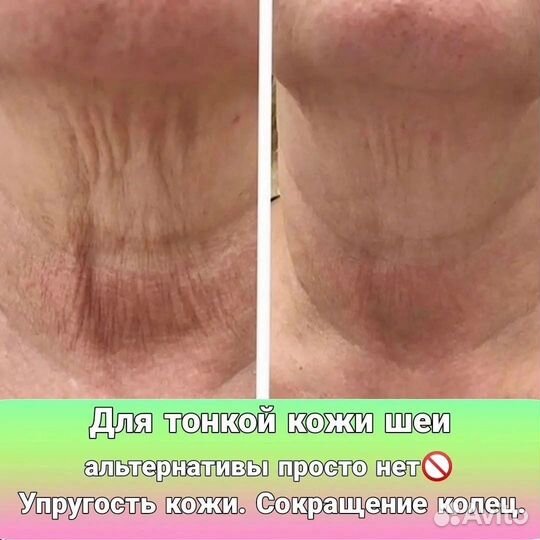 Холодная плазма