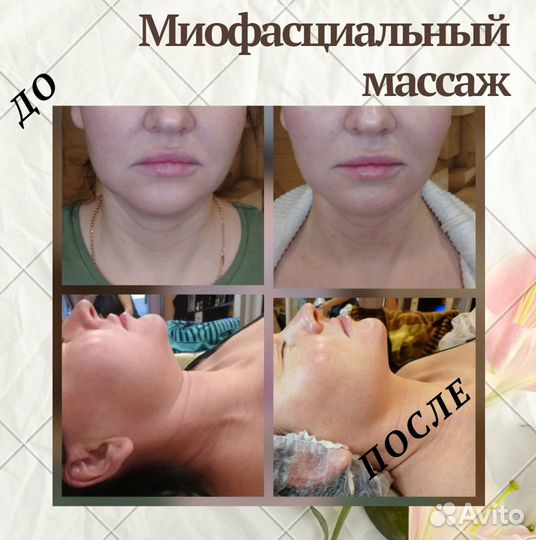 Массаж, аппаратная косметология