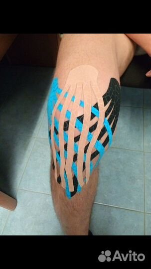 Коррекция фигуры,эстетическое кинезио тейпирование