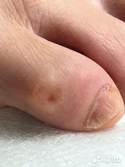 Подология и обучение подологии