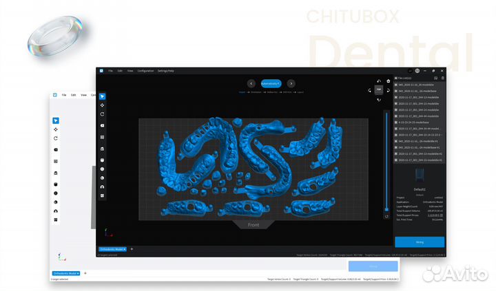ChituBox Dental Pro 1.0.2 / ChituBox Pro 1.4.1