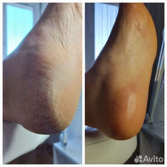 Маникюр и педикюр