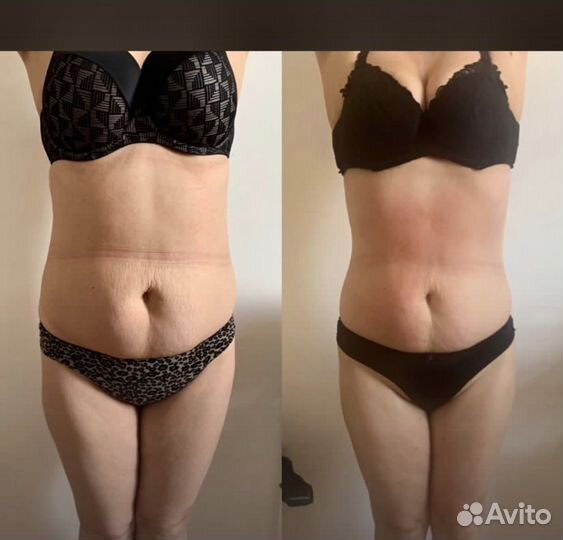 Коррекция фигуры