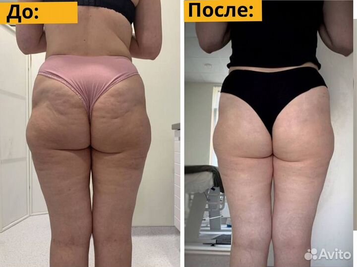 Сертификат на массаж. 100 проц подарок в яблочко