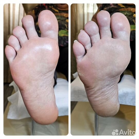 Специалист - Подолог, SMART pedicure