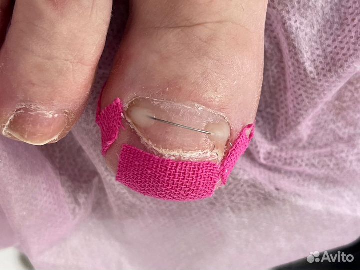 Услуги подолога