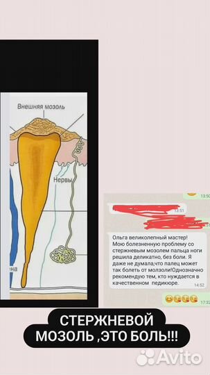 Подологический педикюр