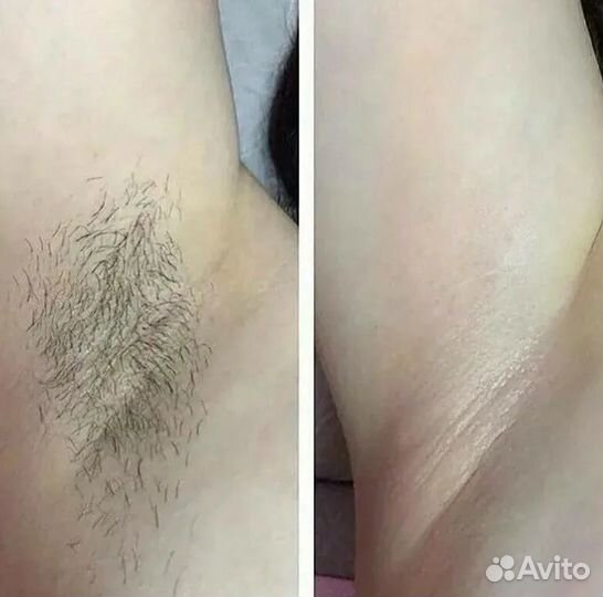 Массажистка,шугаринг