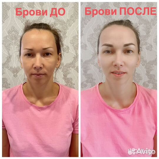 Консультация косметолога