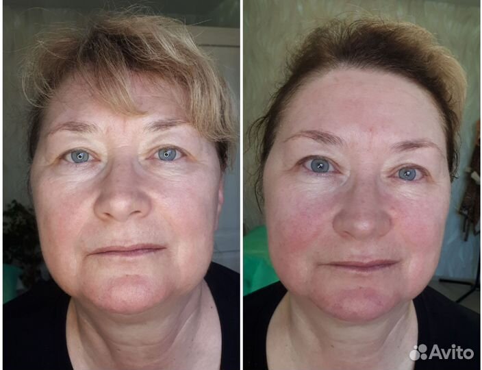 Массаж лица