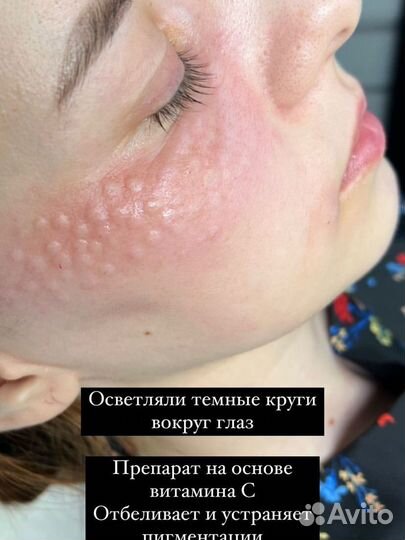 Услуги косметолога