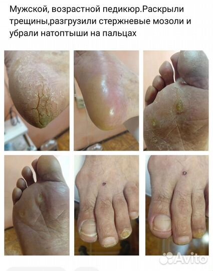 Смарт педикюр