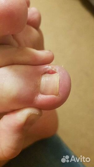 Гигиенический и эстетический педикюр (выезд на дом