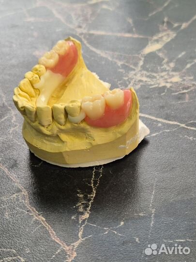 Зуботехнические услуги