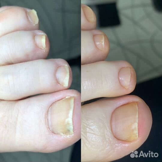 Педикюр, Подолог