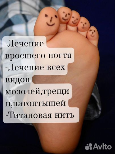 Медицинский педикюр