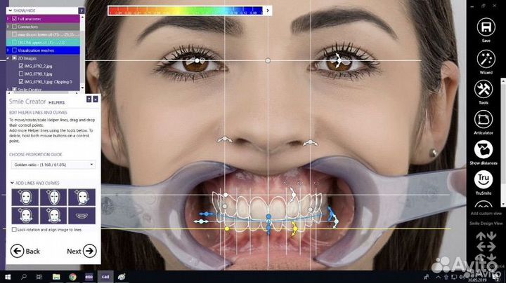 Установка Exocad +видеокурсы по желанию