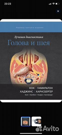 Компьютерная томография