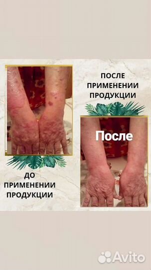 Шунгитовое мыло