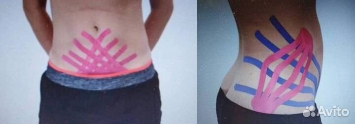 Массаж LPG, кинезиолог, импульсный массаж