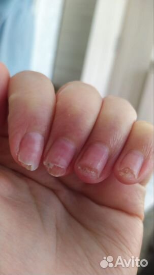 Подолог,выезд круглосуточно 24/7