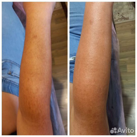 Модели на шугаринг