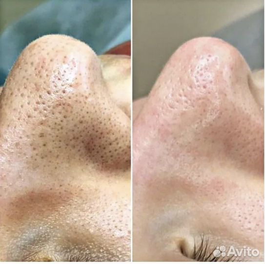 Обучение косметологии