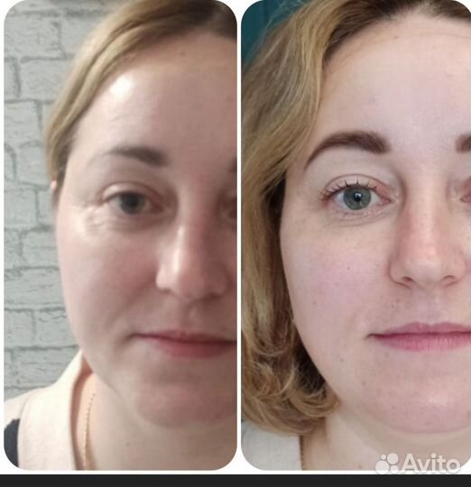 Ручной и аппаратный Массаж, массаж лица. Обучение