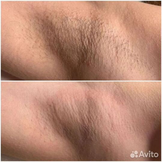 Мастер шугаринга