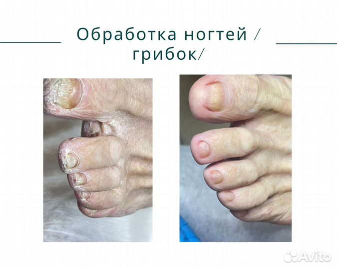 Услуги подолога