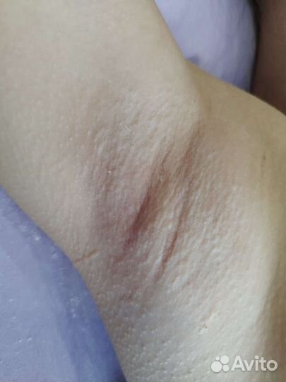 Шугаринг, депиляция