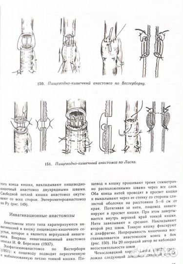 Атлас операций на пищеводе, желудке