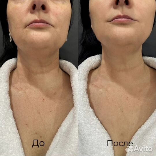 Массаж / СПА процедуры бесплатно