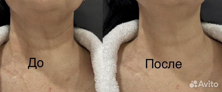 Услуги косметолога