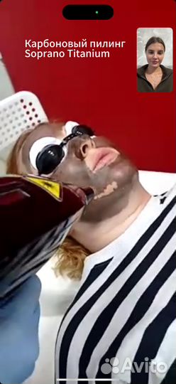 Диодный лазер сопрано