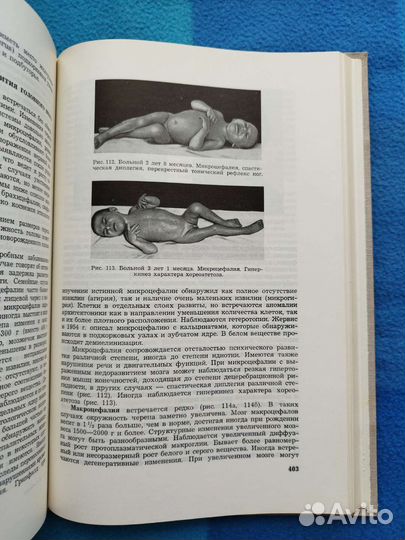 Заболевания нервной системы у детей (неврология)