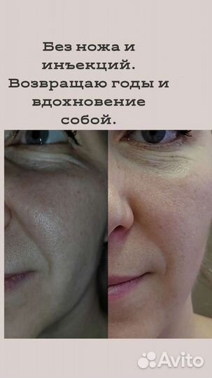 Ручная пластика лица