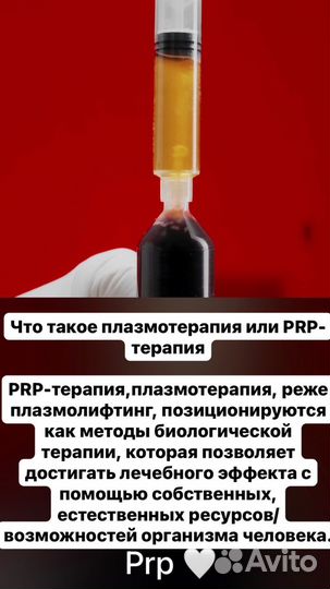 Плазматерапия