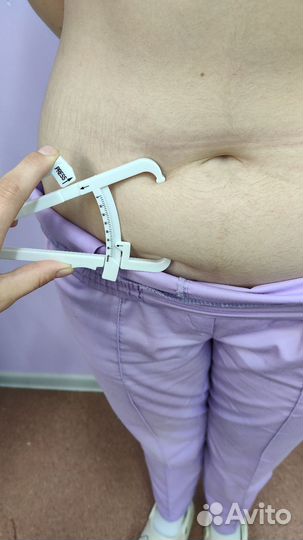 Криолиполиз