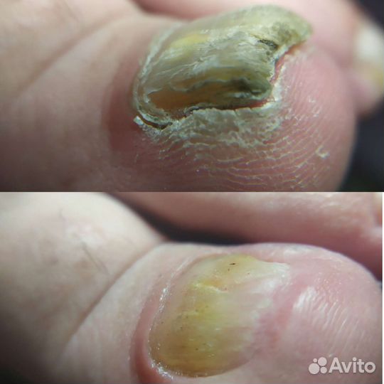 Подология/Педикюр/Чита