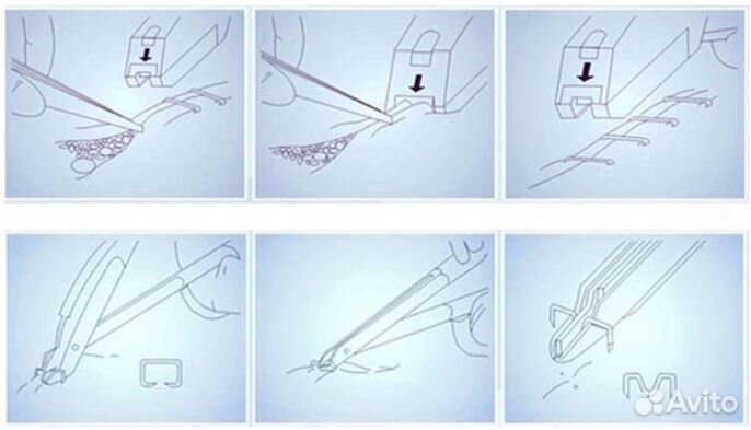 Степплер медицинский хирургический