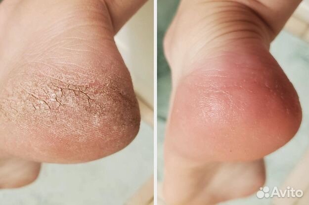 Услуги подолога