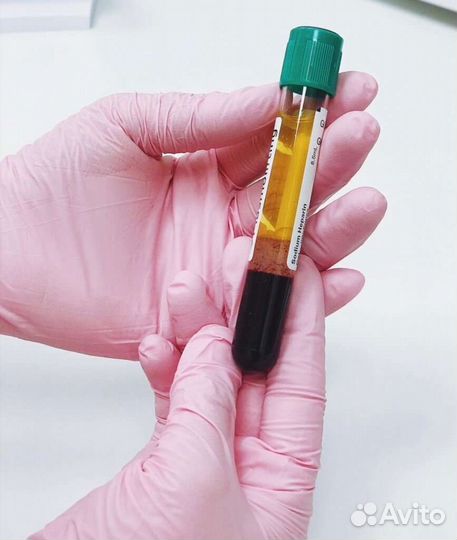 Плазматерапия