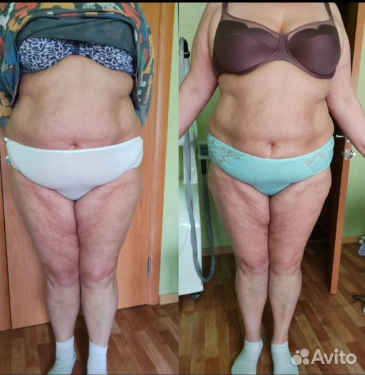 Стройное тело